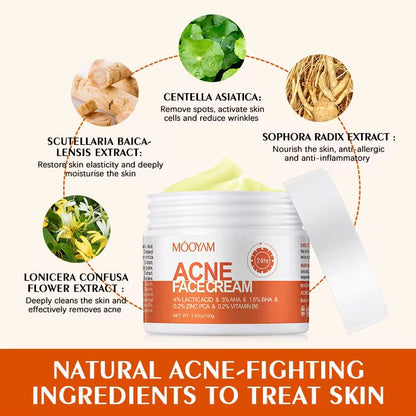 Salicylate Repair Acne Treatment Cream Smallpox Diluting