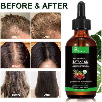 Batana Essential Oil Promotes Hair Growth And Protects Hair