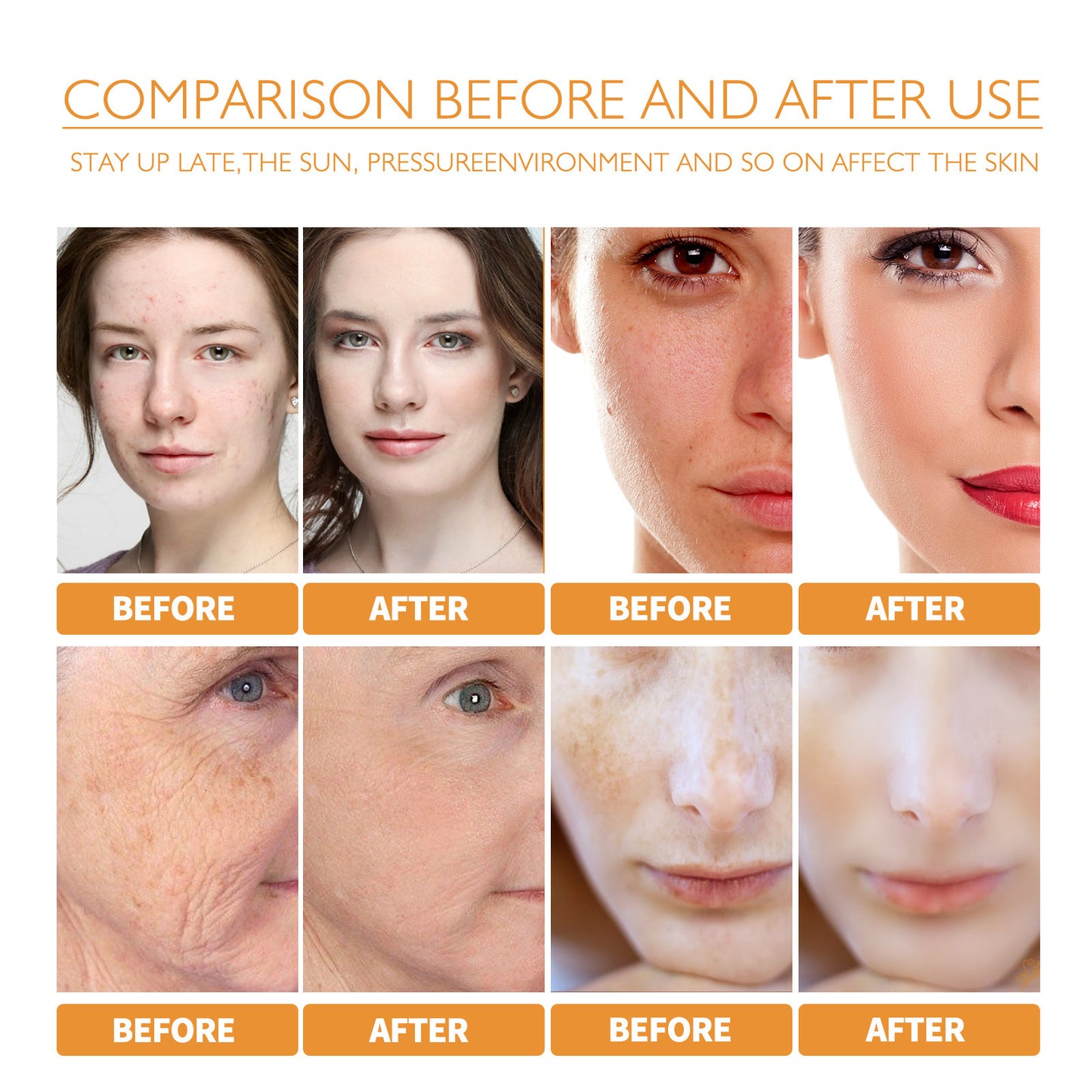 Turmeric Facial Smallpox Diluting Refreshing Oil Control